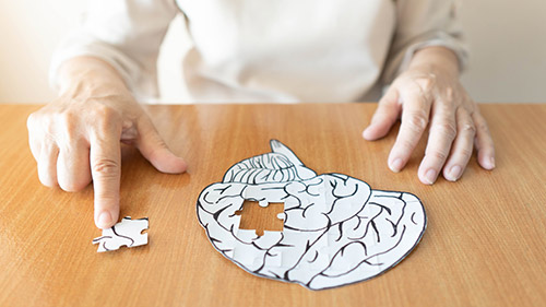The Three Major Alzheimer’s Disease Stages with Brief Description - Athens, GA